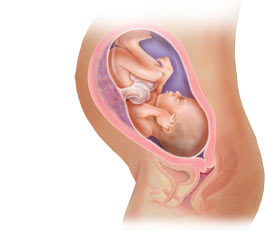 Picture of fetus at 32 weeks